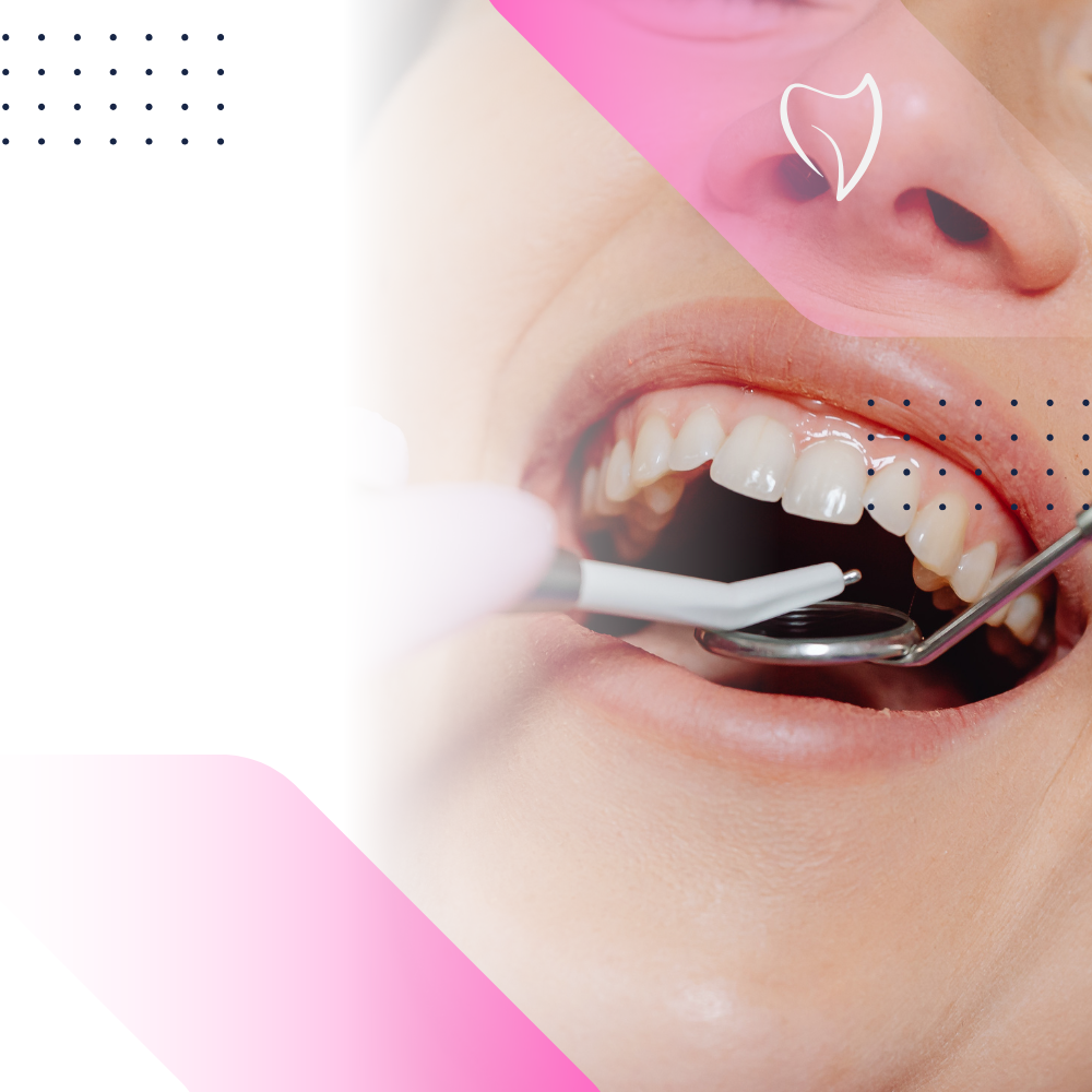 Dental Seo Services